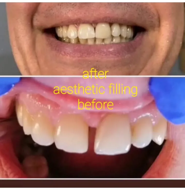 Alanya HEALTHY TEETH Dental Aesthetic — Lääketiede Alanyassa: Online-tilaus, hinnat ja arvostelut