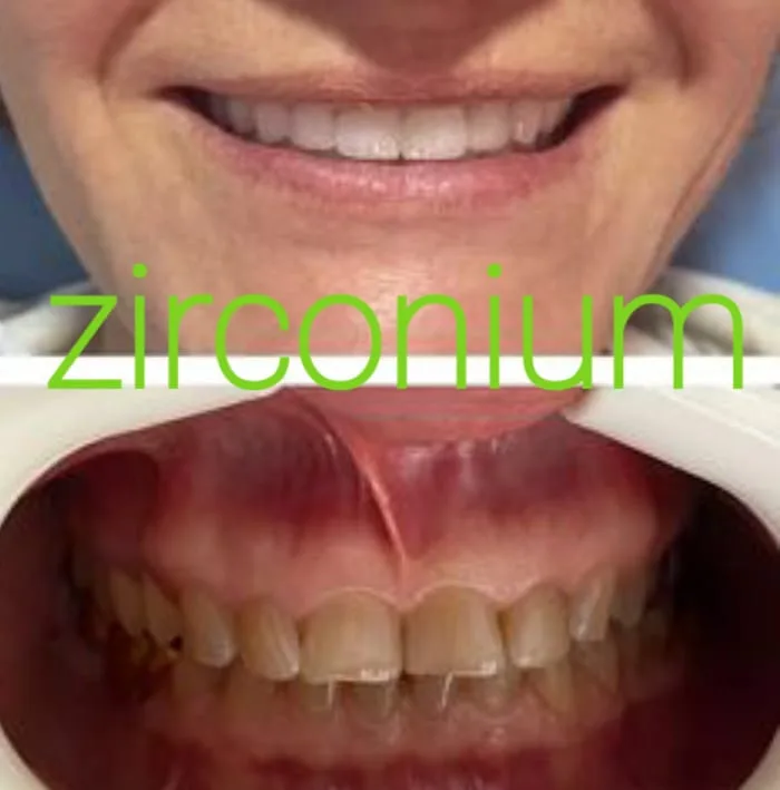 Alanya HEALTHY TEETH Dental Aesthetic — Lääketiede Alanyassa: Online-tilaus, hinnat ja arvostelut