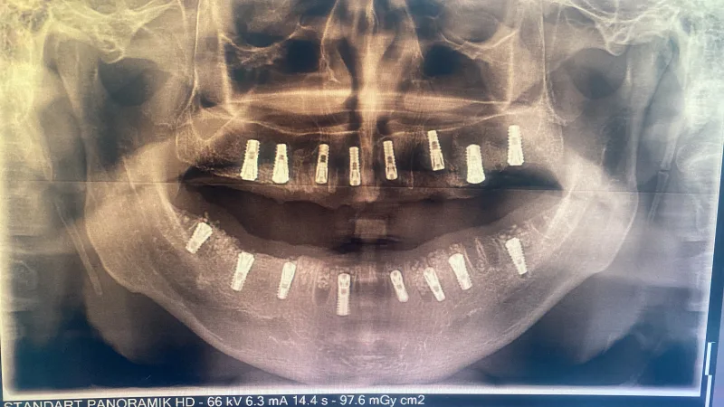 Alanya HEALTHY TEETH Dental Aesthetic — Lääketiede Alanyassa: Online-tilaus, hinnat ja arvostelut