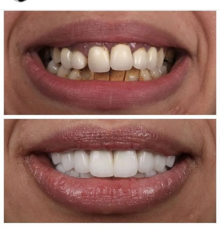 Alanya HEALTHY TEETH Dental Aesthetic — Lääketiede Alanyassa: Online-tilaus, hinnat ja arvostelut