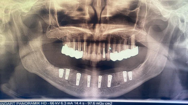 Alanya HEALTHY TEETH Dental Aesthetic — Lääketiede Alanyassa: Online-tilaus, hinnat ja arvostelut
