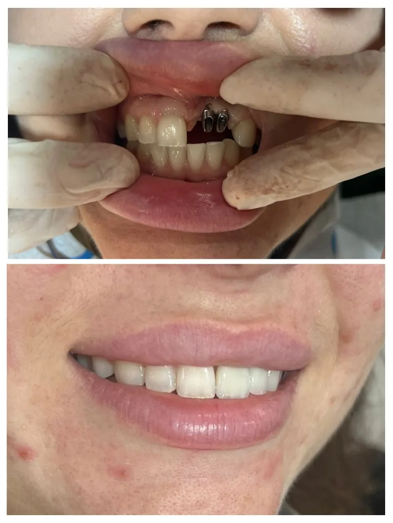 Alanya HEALTHY TEETH Dental Aesthetic — Lääketiede Alanyassa: Online-tilaus, hinnat ja arvostelut