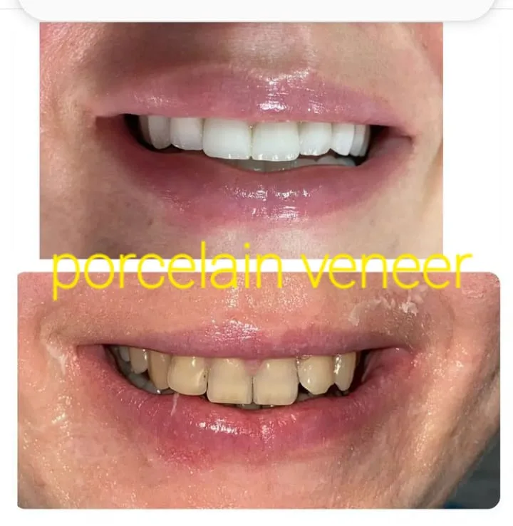 Alanya HEALTHY TEETH Dental Aesthetic — Lääketiede Alanyassa: Online-tilaus, hinnat ja arvostelut